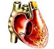 Příčiny a léčba levé komory srdeční selhání