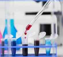 To, co dělá krevní test na CEA a proč by měla trvat?