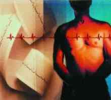 Co diagnózu aterosklerotických kardio
