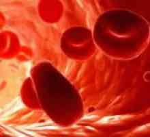 Co na obrázku MCV krev a jaká je jeho pravidlo?