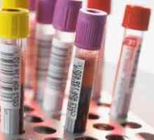 Co je krevní test ASAT a kdy musíme brát