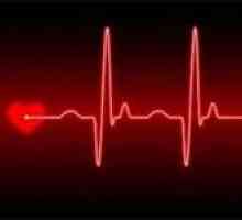 Co je srdeční arytmie, a zda je to nebezpečné pro život?