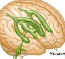 Co je dilatace mozkových komor