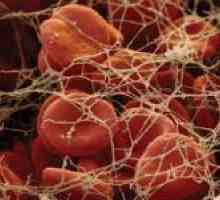 Co je hemostáza a v jakých případech provést krevní test na něm