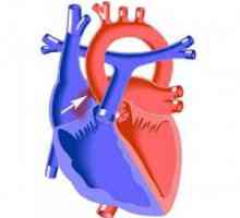 Defektu septa síní srdce u dětí i dospělých: příčiny, příznaky, jak se chovat