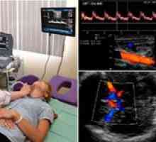 Diagnostické schopnosti ultrazvuk mozkových cév