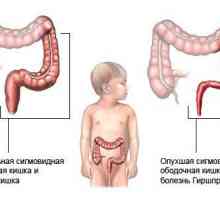 Diagnostika a léčba dítěte dolihosigmoy