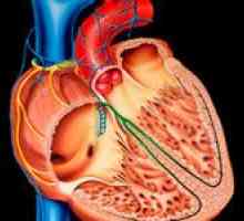 Dilatační kardiomyopatie (DCM) a její léčba