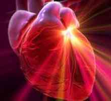 Dyshormonal kardiomyopatie a její léčba