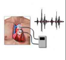 Phonocardiography (PCG), co to je, diagnostické funkce a její interpretace