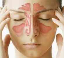 Sinusitida: symptomy, příčiny a léčba