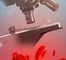 Příčiny nízkého krevního hematokritu
