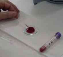 Důvody pro zvýšení hematokritu v krvi