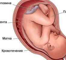 Hematom v děloze během těhotenství