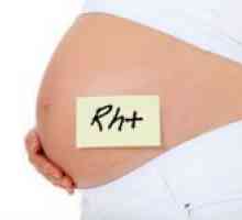 To, co potřebujete vědět o faktoru Rh na fázi plánování těhotenství