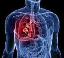 Symptomy plicní krvácení a první pomoc