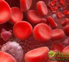 Hematologie varuje jak manifest a ošetřené trombocytopenie
