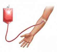 Transfuze krve (krevní transfúze): výzvy a nalézat řešení, čtení, hospodářství, přísady