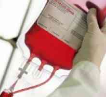 Kompatibilita skupina krve a Rh faktor transfuze