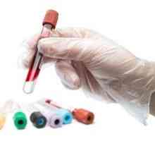 Krevní test pro kalcitoninu - funkce, normy a školení