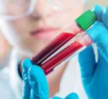 GGT v biochemické analýze krevních: normální hodnoty hladiny enzymu.