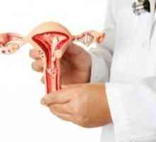Hyperplazie endometria - jak rozpoznat příznaky? správné diagnózy
