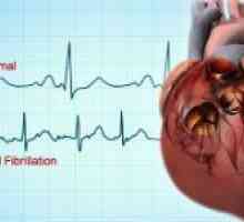 Příznaky různých forem kardiomyopatie a jeho diagnóze