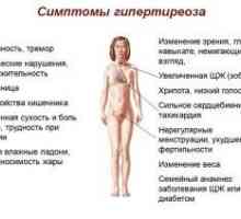 Hypotyreóza je rakovina štítné žlázy u žen: příznaky a léčba