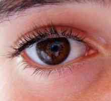 Oční tlak: příznaky růstu, symptomy a léčbu.