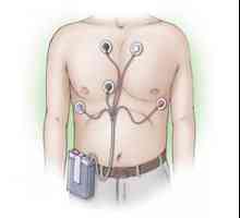 Holter monitoring (Holter monitoring) EKG a peklo: čtení, hospodářství, cena, výsledky