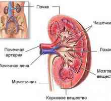 Chronická pyelonefritida, infekce má ledvinu