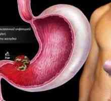 Chronická povrchová gastritidu: léčba lidových opravné