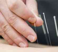 Akupunktura - za staletí zkušenosti z tradiční orientální medicíně