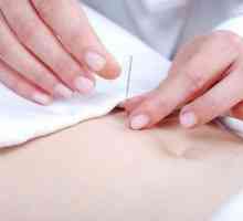 Akupunktura pomáhá hubnout