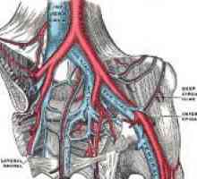 Ileofemoralny trombóza dolních končetin