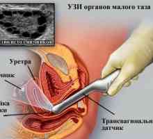Intimní otázky: Je možné provést ultrazvukové vyšetření při menstruaci? 2