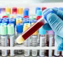 Krevní test pro EIA