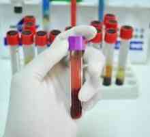 Výzkum srážení krve - hemostasiogram (koagulace): účel a dešifrování