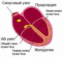 Onemocnění kardiovaskulárního systému (kardiovaskulární onemocnění): přehled, symptomy, principy…