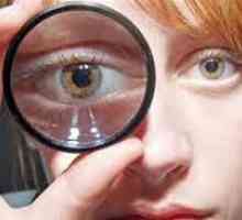 Endokrinní onemocnění oka - endokrinní oftalmopatie
