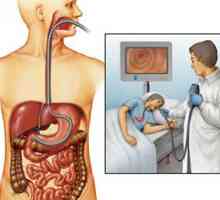 Endoskopie žaludku - to je vzhledem k postupu?