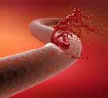 Jak rychle zastavit krvácení z rány