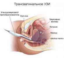 Jak se vaginální ultrazvuk: přípravu, řízení a dekódování
