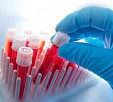 Jak a proč bych měl darovat krevní test pro toxoplazmózu