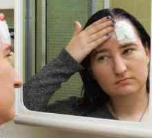 Jak léčit hematom na hlavě po nárazu