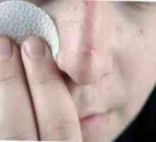 Jak k léčbě akné na nose, a proto se objevují?