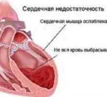 Jak k léčbě srdečního selhání