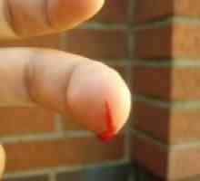 Jak zastavit krvácení z prstu
