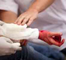Rysy žilní krvácení a akutní péče