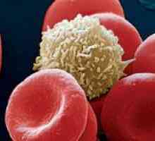 Jak zvýšit počet bílých krvinek v krvi po chemoterapii?